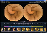 Highest Frame Rate: MiroCam capsule captures images at 3 frames per second. At least 118,800 images are obtained (over 11 hours).